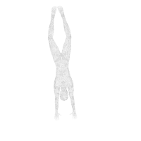 Diagram of bowed out knees